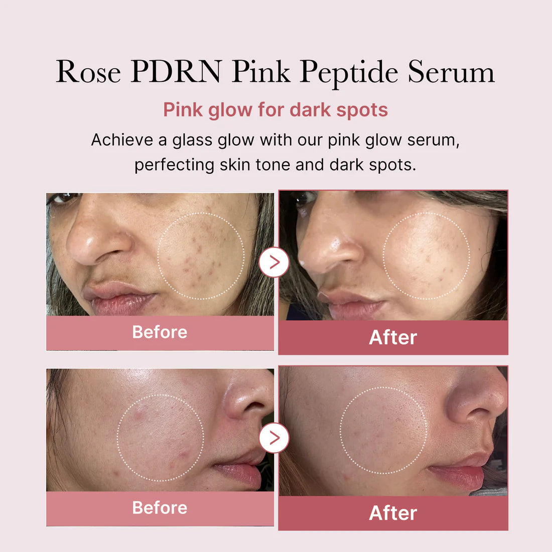 Medicube- PDRN Pink Peptide Serum (Rose Vegan)