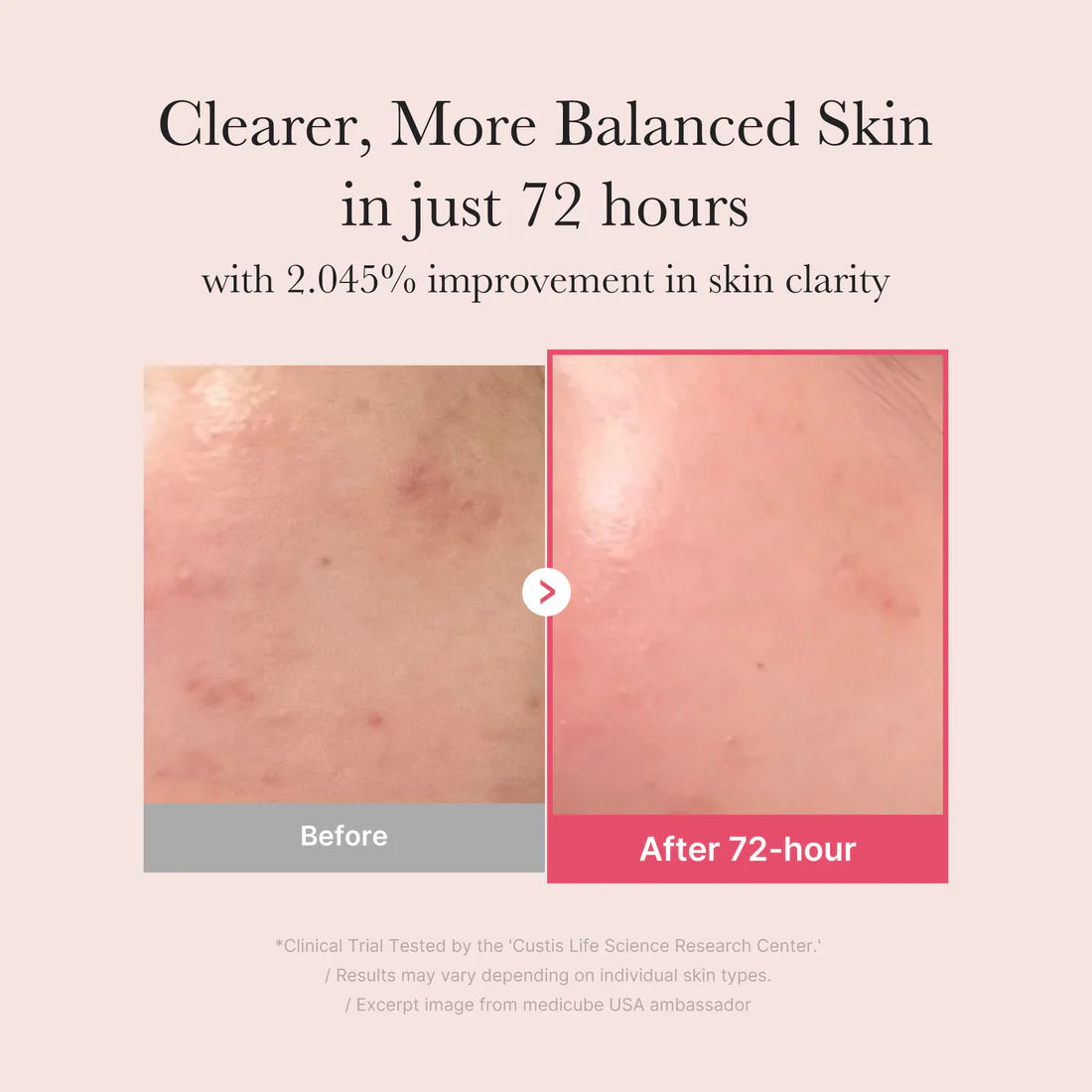 Medicube- TXA Niacinamide Serum