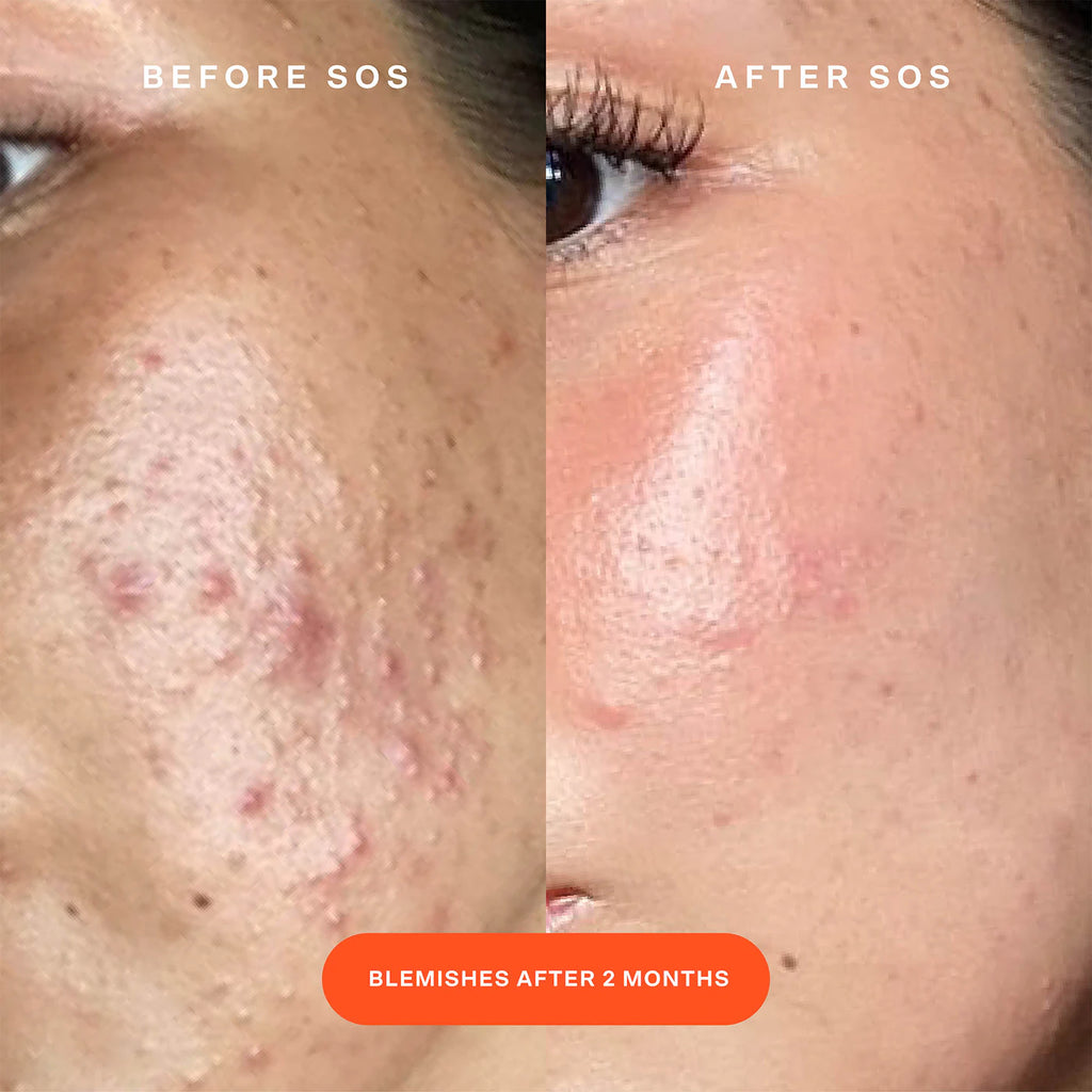 Tower 28- SOS Daily rescue facial spray