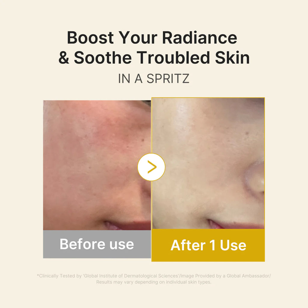 Medicube- Kojic Acid Turmeric Vitamin Gold Jelly Mist Serum