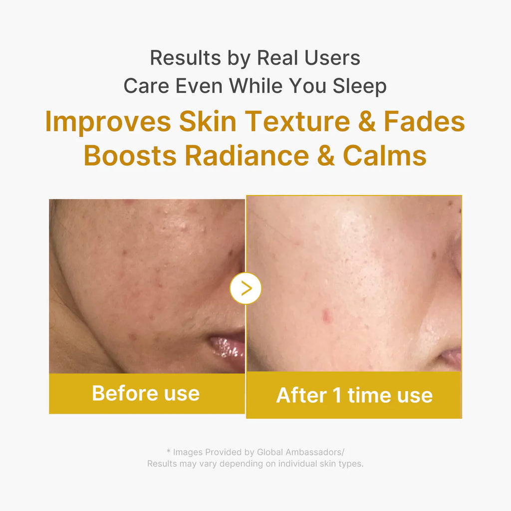 Medicube- Kojic Acid Turmeric Overnight Wrapping Mask