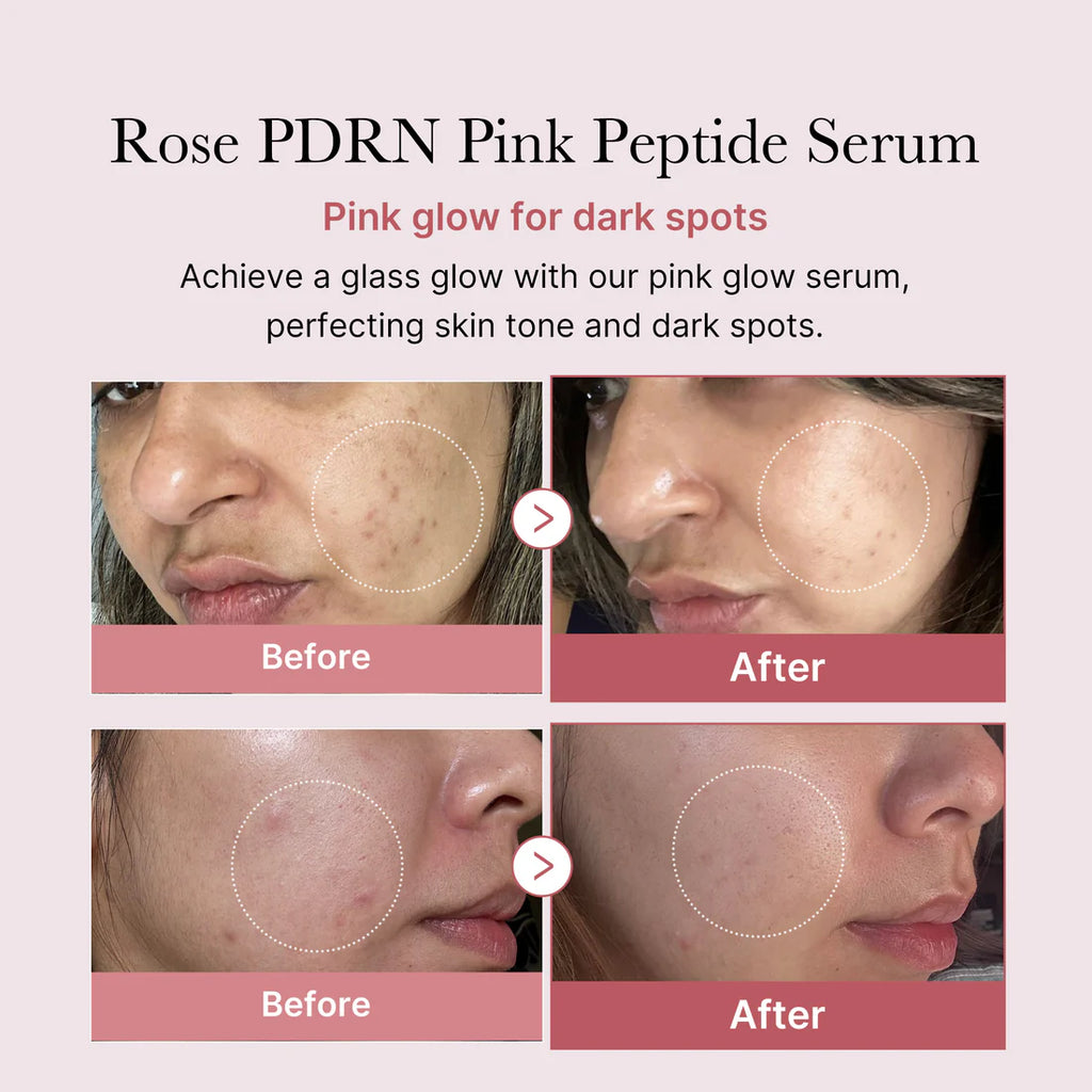 Medicube- PDRN Pink Peptide Serum (Rose Vegan)